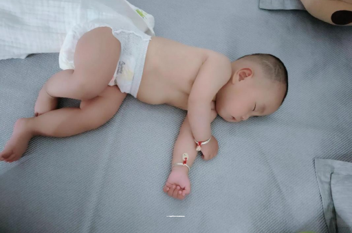文山六个月宝宝眼睛散光